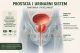 Prostata i urinarni sistem muškarca